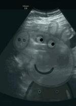 搞笑b超图猴子,搞笑B超图里的欢乐猴子瞬间